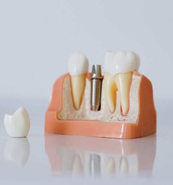 Dental Implants in Kennett, MO