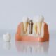 Dental Implants in Kennett, MO