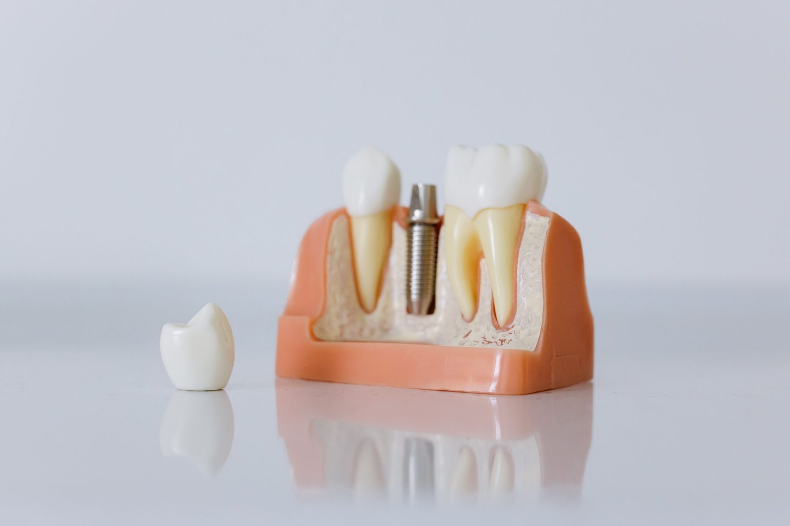 Dental Implants in Kennett, MO